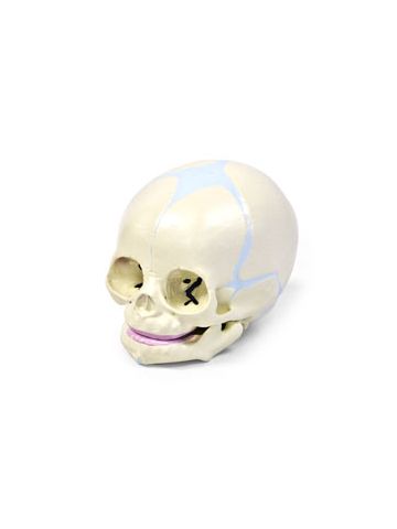  Human Fetal Skull