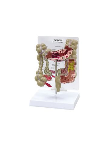 Colon Model